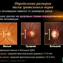 Астахов Ю.С. Ранняя диагностика глаукомы. Доклад. Белые ночи-2011, 01 июня 2011г., Санкт-Петербург, Россия. Astakhov YS Early diagnosis of glaucoma. Академия глаукомы, Academy Glaucoma. Клуб знатоков. Офтальмологический портал Орган зрения www.organum-visus.com