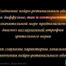Астахов Ю.С. Ранняя диагностика глаукомы. Доклад. Белые ночи-2011, 01 июня 2011г., Санкт-Петербург, Россия. Astakhov YS Early diagnosis of glaucoma. Академия глаукомы, Academy Glaucoma. Клуб знатоков. Офтальмологический портал Орган зрения www.organum-visus.com
