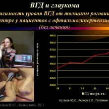 Астахов Ю.С. Ранняя диагностика глаукомы. Доклад. Белые ночи-2011, 01 июня 2011г., Санкт-Петербург, Россия. Astakhov YS Early diagnosis of glaucoma. Академия глаукомы, Academy Glaucoma. Клуб знатоков. Офтальмологический портал Орган зрения www.organum-visus.com