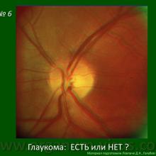 Фокус на диагностику. Focus on the diagnosis. Программа ONE, The Programm ONE: Optic Nerve Evaluation. Академия глаукомы. Клуб знатоков офтальмологии на портале Орган зрения www.organum-visus.com