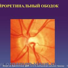 Фокус на диагностику, Diagnosis in focus. Диагностическая ценность осмотра диска зрительного нерва и слоя нервных волокон сетчатки при глаукоме. Профессор Курышева Н.И., г. Москва, Россия. По материалам компании Пфайзер. «АкадемиЯ Глаукомы» Academy Glaucoma инновационный образовательный проект для офтальмологов при поддержке компании Пфайзер. Опубликовано в разделе Клуб знатоков портала Орган зрения www.organum-visus.com, дизайн слайдов подготовил Голубев С.Ю.