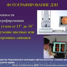 Фокус на диагностику, Diagnosis in focus. Диагностическая ценность осмотра диска зрительного нерва и слоя нервных волокон сетчатки при глаукоме. Профессор Курышева Н.И., г. Москва, Россия. По материалам компании Пфайзер. «АкадемиЯ Глаукомы» Academy Glaucoma инновационный образовательный проект для офтальмологов при поддержке компании Пфайзер. Опубликовано в разделе Клуб знатоков портала Орган зрения www.organum-visus.com, дизайн слайдов подготовил Голубев С.Ю.