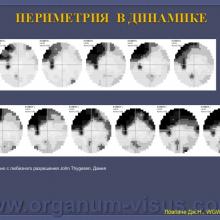 Ловпаче Дж.Н. WGW-2013. Достижения. Перспективы. Что дальше? 06 марта 2013г., телемост г. Москва-Санкт-Петербург, Россия. Академия Глаукомы, Academy Glaucoma. При поддержке компании Пфайзер. Информационный партнер www.organum-visus.com